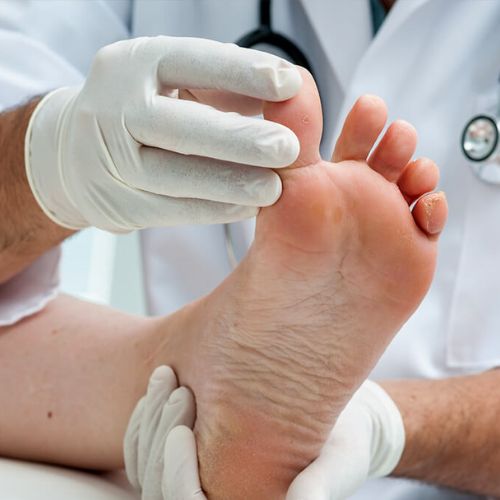 Mobile Foot Care Ottawa