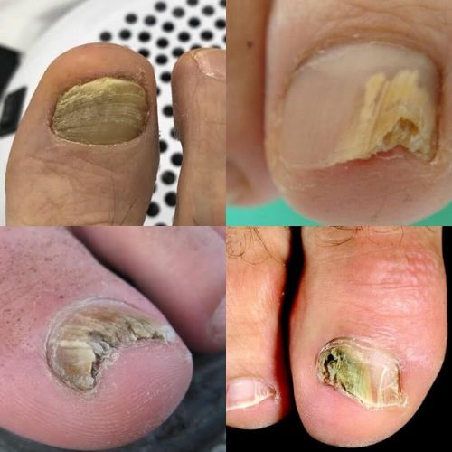 Mobile Foot Care Ottawa